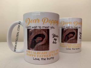 I can't wait to meet you ultrasound Mug Design - Father's Day