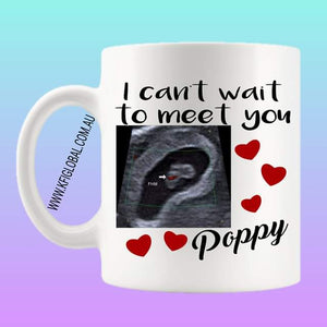 I can't wait to meet you ultrasound Mug Design